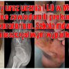 Poważny uraz ucznia I LO w Malborku. Rodzice zawiadomili prokuraturę i kuratorium. Szkoła mówi o nieszczęśliwym wypadku